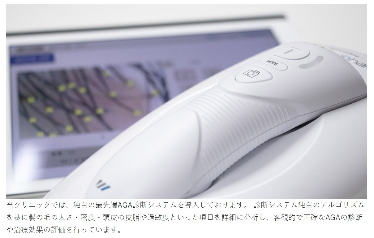 AGAメディカルケアクリニックのAGA診断システムについて