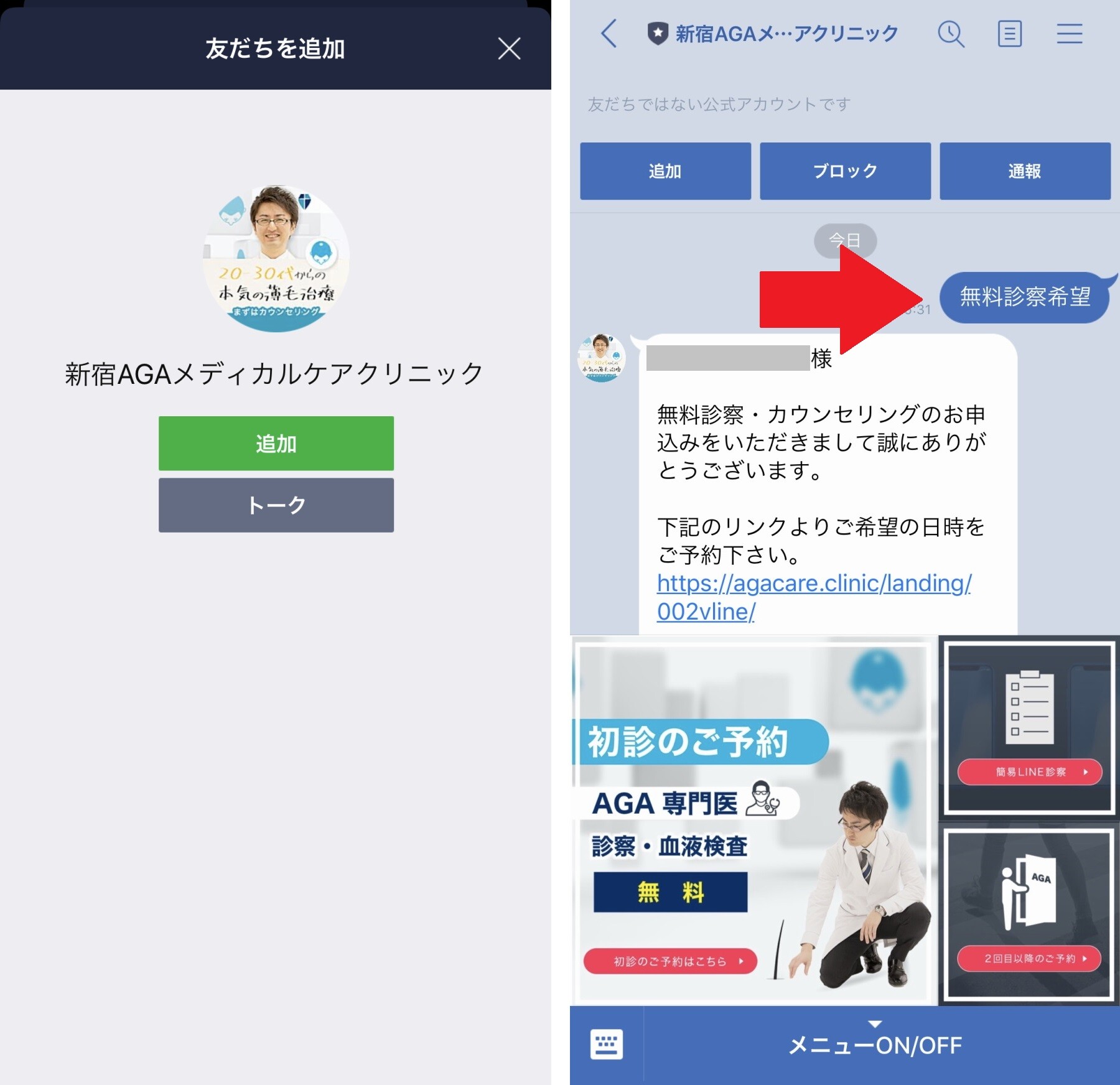 AGAメディカルケアクリニックのLINE