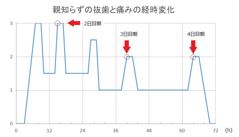 親知らず抜歯に伴う痛みの経時変化